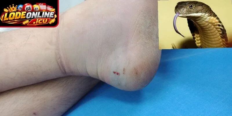 Giải mã ý nghĩa khi mơ bị rắn cắn vào chân
